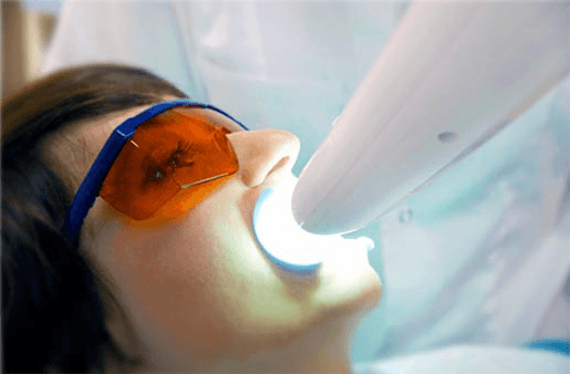 Understanding the Causes of Teeth Sensitivity Wakefield