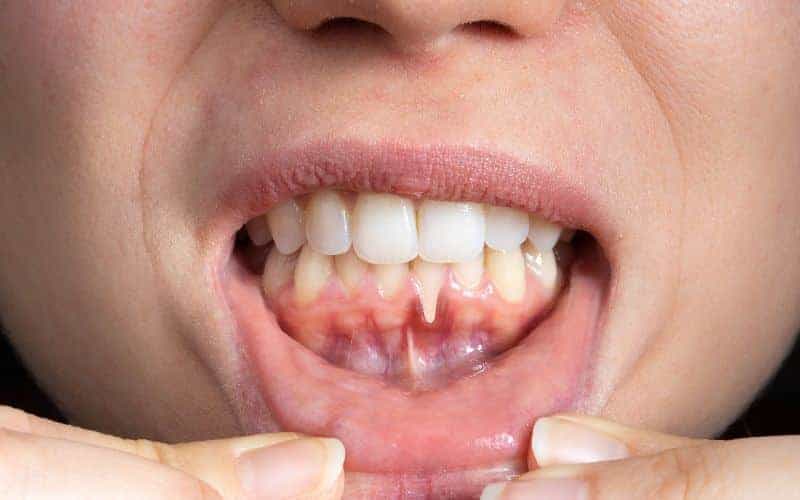 Final Thoughts: Building Lifelong Enamel Protection Habits Wakefield