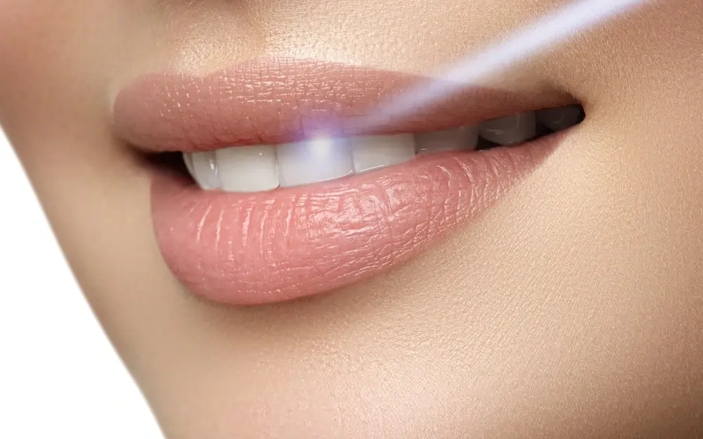 A Smarter Alternative: At-Home Laser Teeth Whitening Wakefield