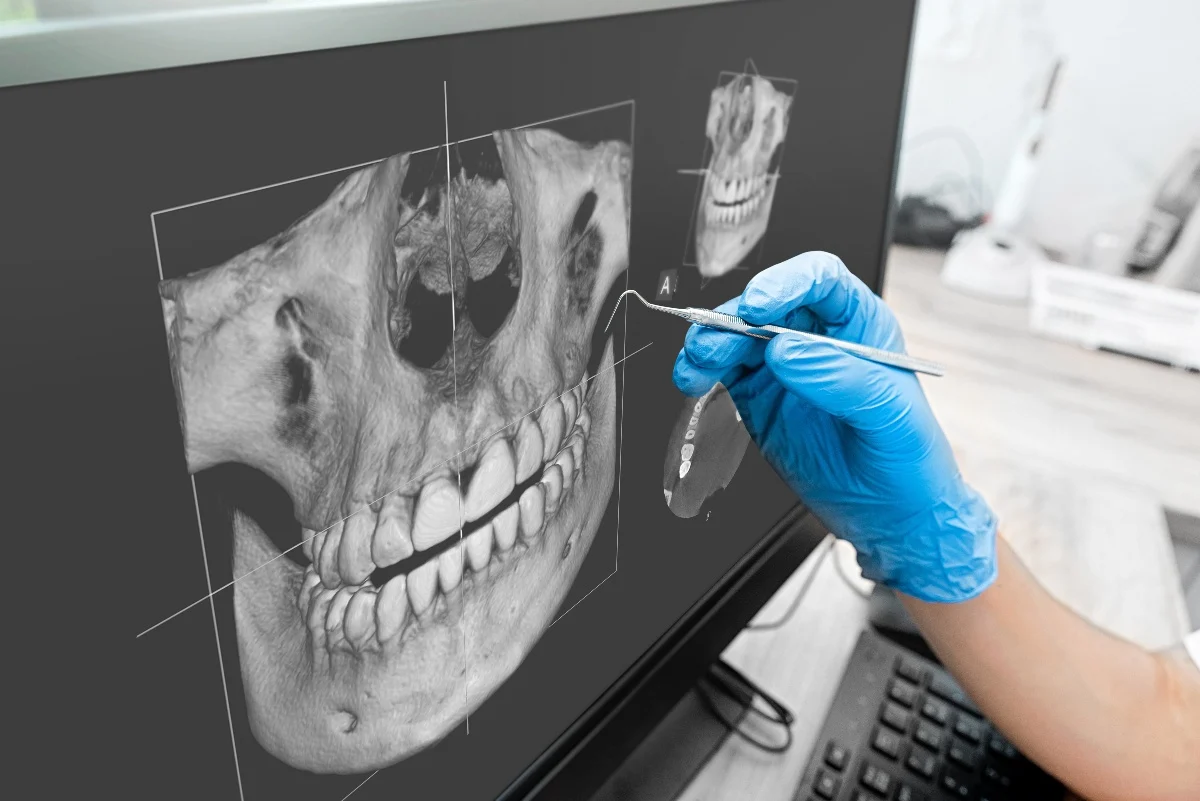 How Is AI Transforming Dental Treatment Planning Wakefield?