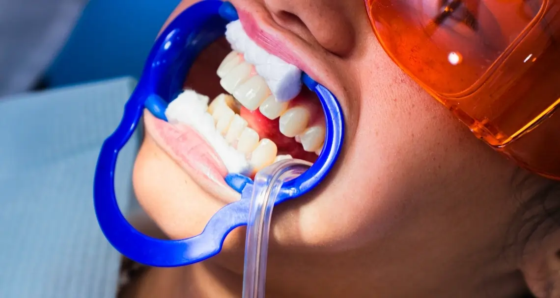 Professional Maintenance and Touch-Up Treatments Wakefield