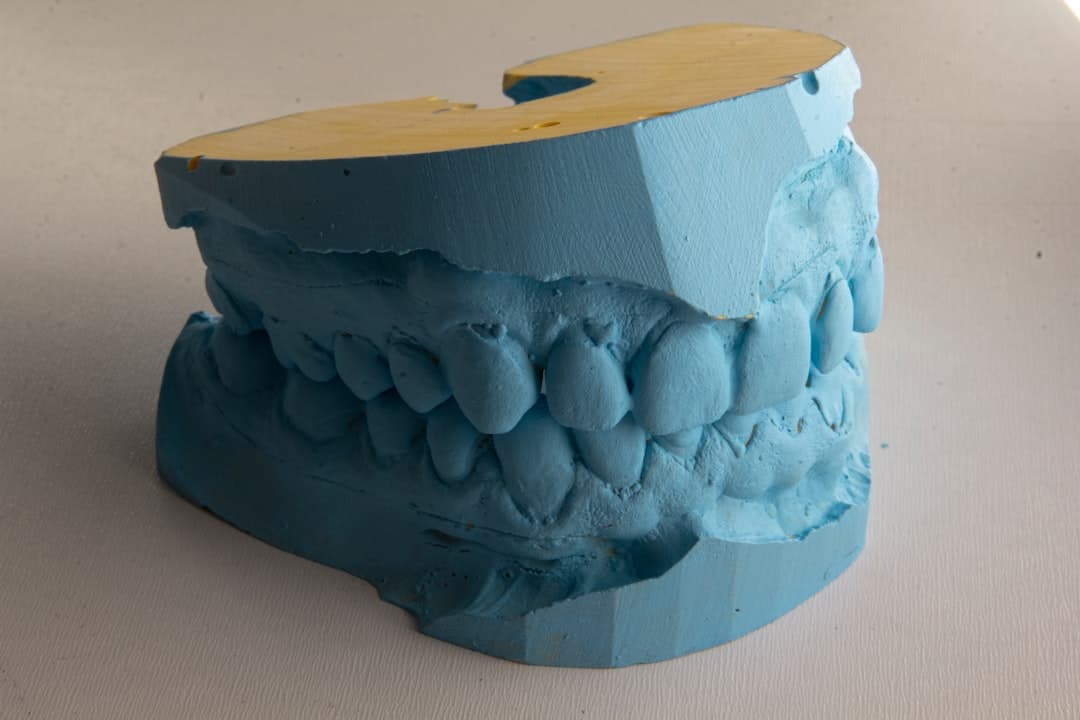 How Do Dental Implants Improve Jawbone Health and Oral Function Wakefield?