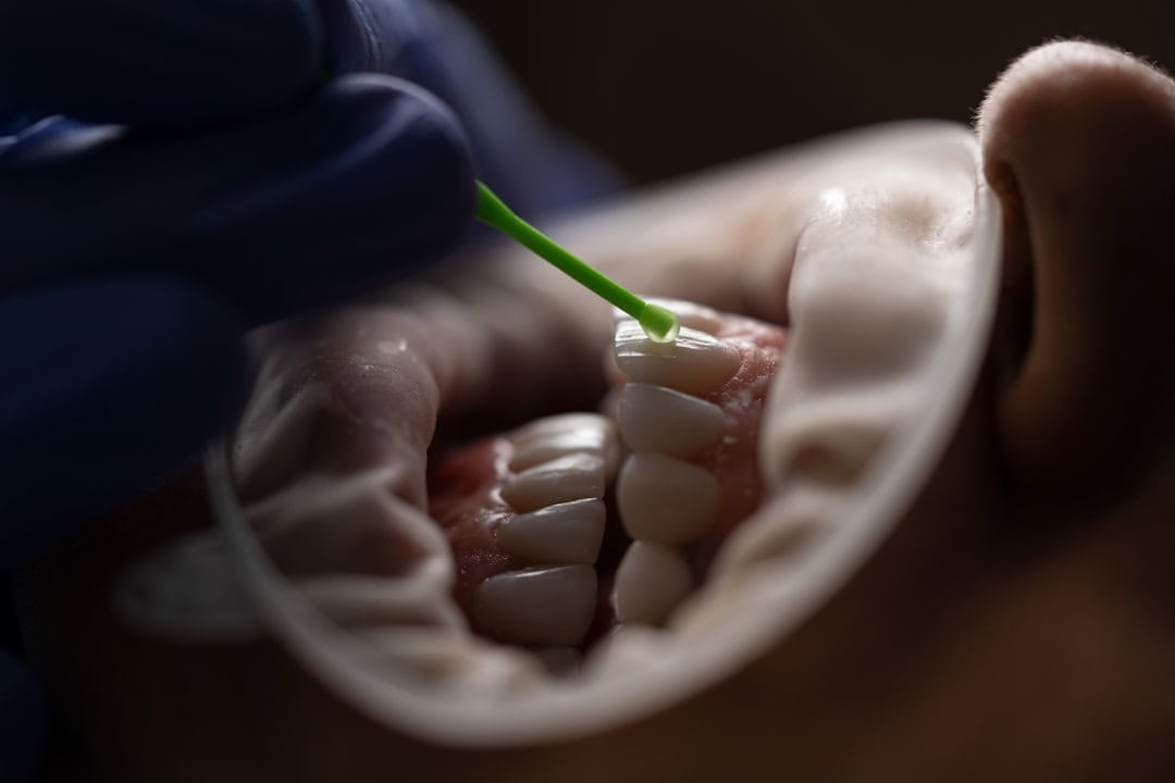 How Saliva Protects Your Teeth and Gums Wakefield
