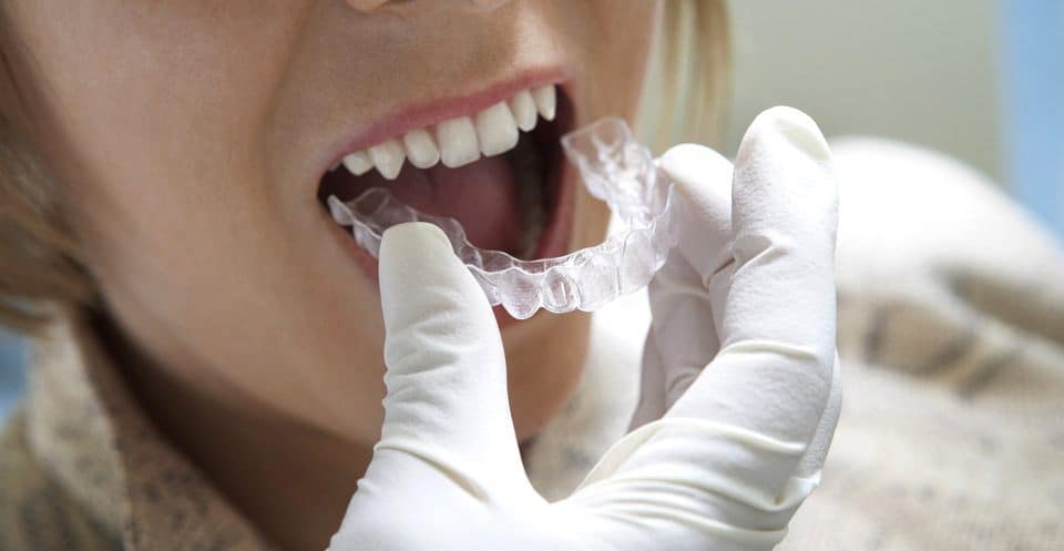 Can Bruxism Affect Your Sleep Quality Wakefield