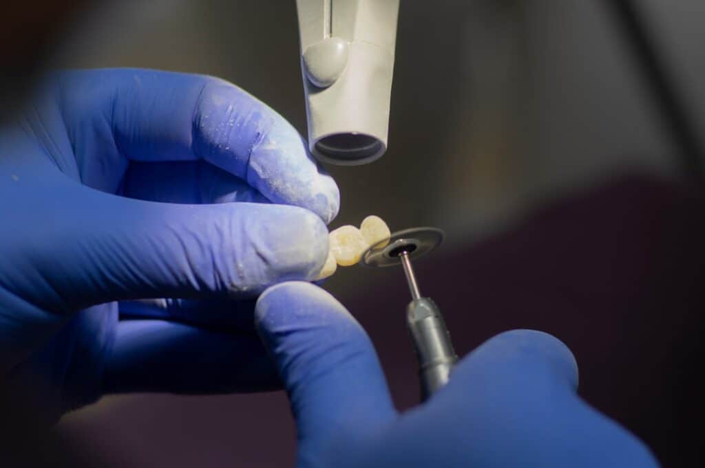 Customised Dental Solutions: Crowns, Aligners, and Implants Wakefield